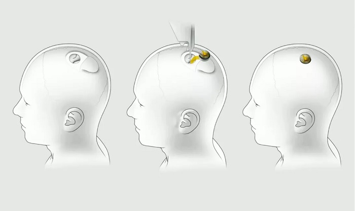 f6ac8133b8341ad.jpg